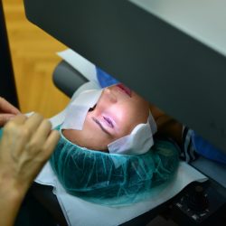 lasersko uklanjanje dioptrije2
