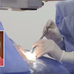 operacija katarakte dr branka ivosevic3 1