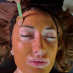 face gym tretman 1